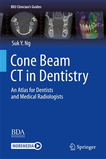 Cone Beam CT in Dentistry An Atlas for Dentists and Medical Radiologists