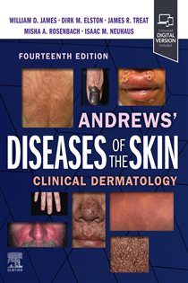 Andrews' Diseases of the Skin E-Book (14th ed.) Clinical Dermatology