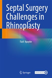 Septal Surgery Challenges in Rhinoplasty