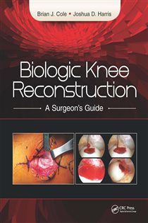 Biologic Knee Reconstruction A Surgeon's Guide
