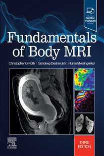 Fundamentals of Body MRI E-Book (3rd ed.)