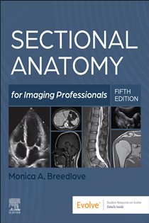 Sectional Anatomy for Imaging Professionals - E-Book (5th ed.)