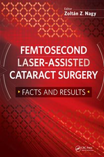 Femtosecond Laser-Assisted Cataract Surgery Facts and Results