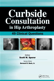 Curbside Consultation in Hip Arthroplasty 49 Clinical Questions