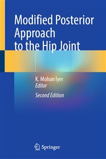 Modified Posterior Approach to the Hip Joint (2nd ed.)