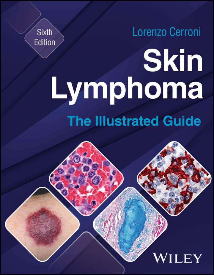 Skin Lymphoma: The Illustrated Guide 6th Edition
