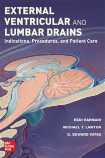 External Ventricular and Lumbar Drains: Indications, Procedures, and Patient Care