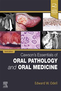 Cawson's Essentials of Oral Pathology and Oral Medicine - E-Book (10th ed.)