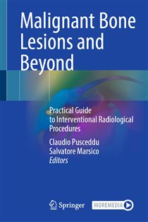 Malignant Bone Lesions and Beyond Practical Guide to Interventional Radiological Procedures