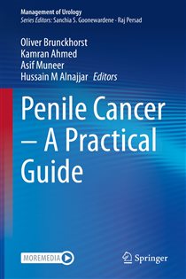 Penile Cancer â€“ A Practical Guide