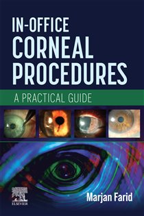 In-Office Corneal Procedures - E-BOOK A Practical Guide