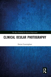 Clinical Ocular Photography
