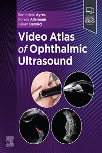Video Atlas of Ophthalmic Ultrasound - E-Book