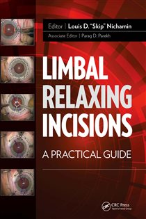 Limbal Relaxing Incisions A Practical Guide