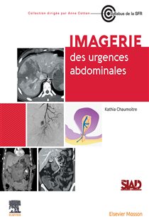 Imagerie des urgences abdominales