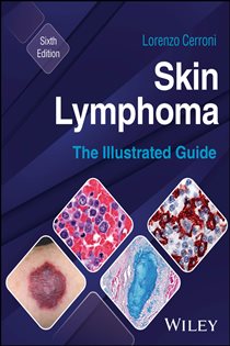 Skin Lymphoma (6th ed.) The Illustrated Guide