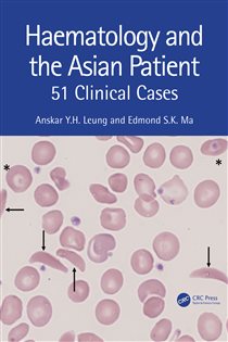 Haematology and the Asian Patient 51 Clinical Cases