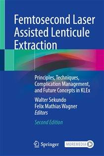 Femtosecond Laser Assisted Lenticule Extraction (2nd ed.)