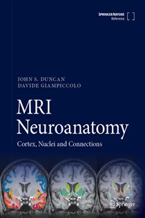 MRI Neuroanatomy Cortex, Nuclei and Connections