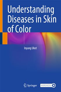 Understanding Diseases in Skin of Color