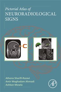 Pictorial Atlas of Neuroradiological Signs