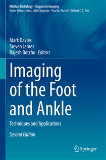 Imaging of the Foot and Ankle (2nd ed.) Techniques and Applications